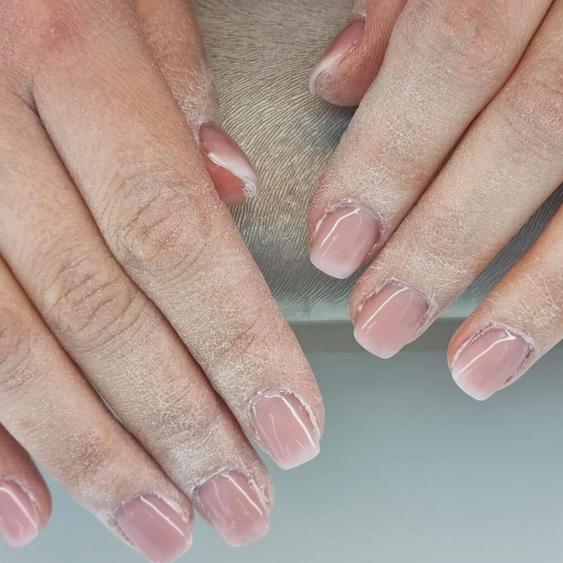Naturnägel vor der Behandlung